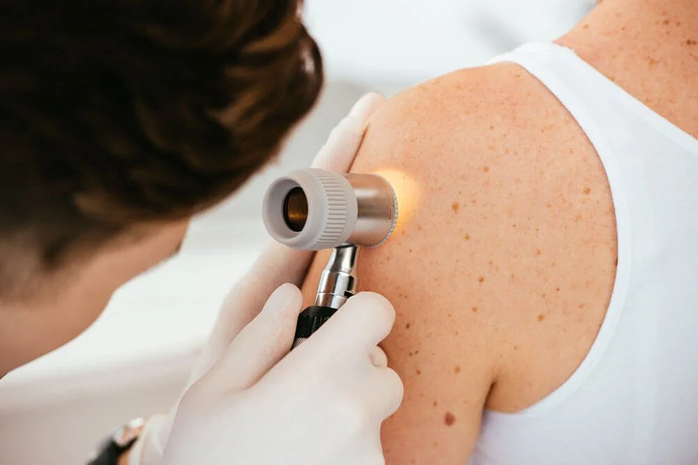 Atopic Dermatitis clinical trials